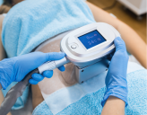 Bei der Behandlung einer Kryolipolyse-Sitzung